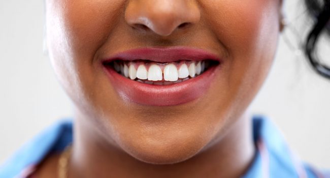 oral care, dental hygiene and people concept - close up of Estética dental - Clínica Dentária New Dente